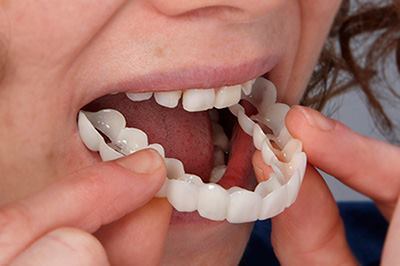 diseno sonrisa 2